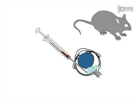 Establishment and Propagation of Human Retinoblastoma Tumors in Immune Deficient Mice