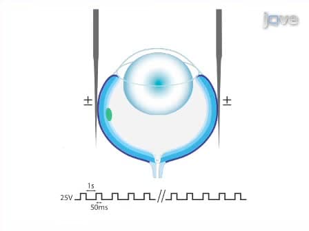 Transfection of Mouse Retinal Ganglion Cells by <em>in vivo</em> Electroporation