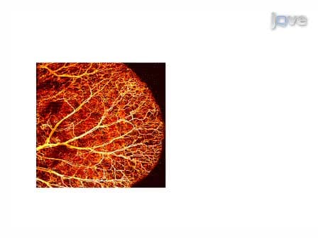 Three-dimensional Optical-resolution Photoacoustic Microscopy