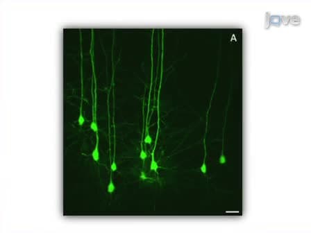 A Rapid Approach to High-Resolution Fluorescence Imaging in Semi-Thick Brain Slices