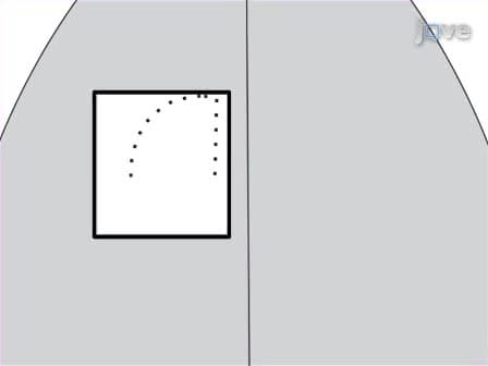 Preparing Undercut Model of Posttraumatic Epileptogenesis in Rodents