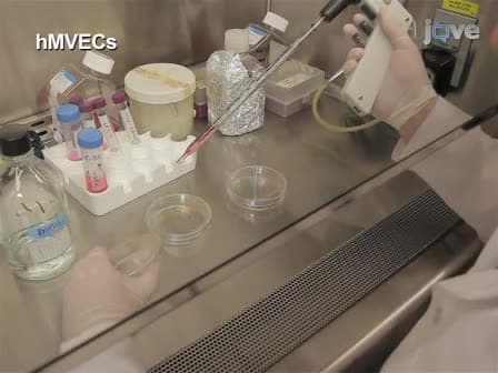 A Matrigel-Based Tube Formation Assay to Assess the Vasculogenic Activity of Tumor Cells