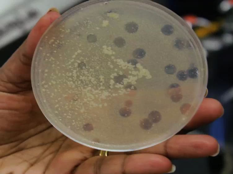 Aseptic Laboratory Techniques: Plating Methods