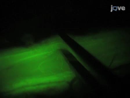 Live Imaging of Dorsal Root Axons after Rhizotomy