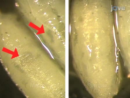 <em>Drosophila</em> Pupal Abdomen Immunohistochemistry