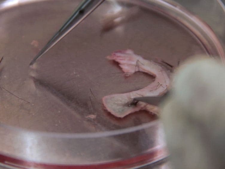 Isolation and Culture of Neural Crest Stem Cells from Human Hair Follicles