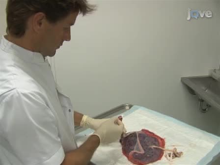 Accurate and Simple Evaluation of Vascular Anastomoses in Monochorionic Placenta using Colored Dye