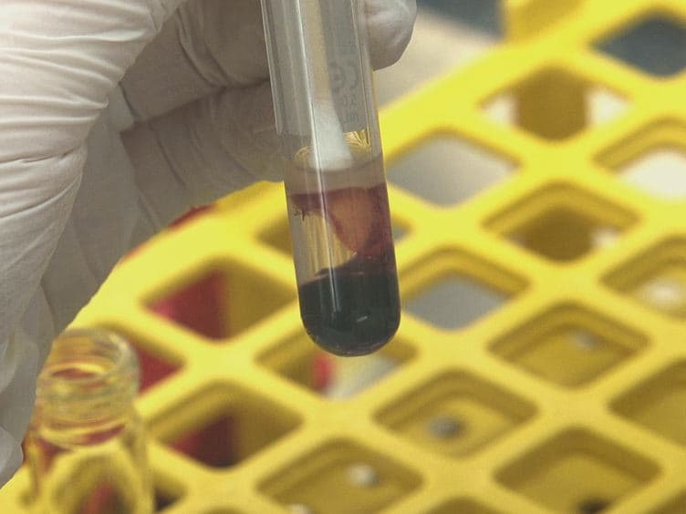 One-day Workflow Scheme for Bacterial Pathogen Detection and Antimicrobial Resistance Testing from Blood Cultures