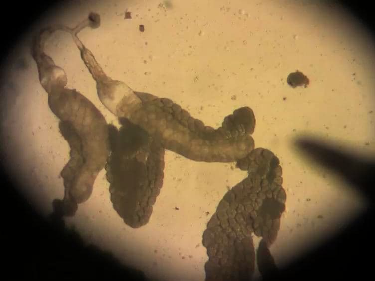 An Introduction to Parasitic Wasps of Drosophila and the Antiparasite Immune Response