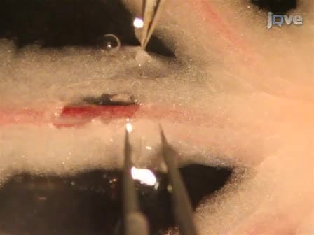 Measurement of Cytosolic Ca2+ in Isolated Contractile Lymphatics