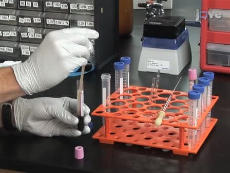 Detection and Isolation of Circulating Melanoma Cells using Photoacoustic Flowmetry
