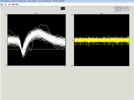 Surgical Implantation of Chronic Neural Electrodes for Recording Single Unit Activity and Electrocorticographic Signals