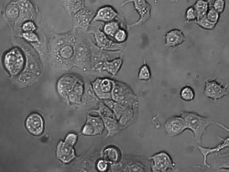 Enhancement of Apoptotic and Autophagic Induction by a Novel Synthetic C-1 Analogue of 7-deoxypancratistatin in Human Breast Adenocarcinoma and Neuroblastoma Cells with Tamoxifen