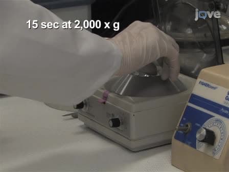 Amide Hydrogen/Deuterium Exchange & MALDI-TOF Mass Spectrometry Analysis of Pak2 Activation