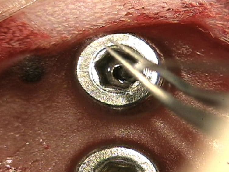 Epidural Intracranial Pressure Measurement in Rats Using a Fiber-optic Pressure Transducer