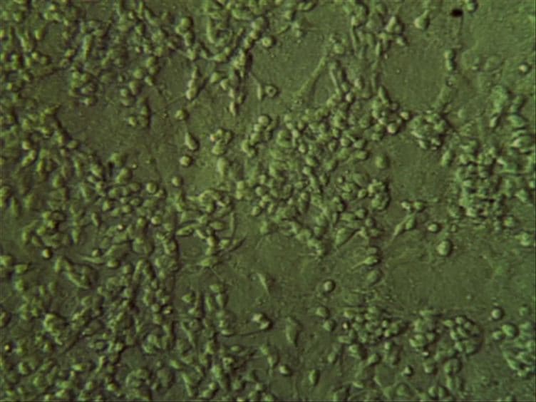 The Neuroblast Assay: An Assay for the Generation and Enrichment of Neuronal Progenitor Cells from Differentiating Neural Stem Cell Progeny Using Flow Cytometry