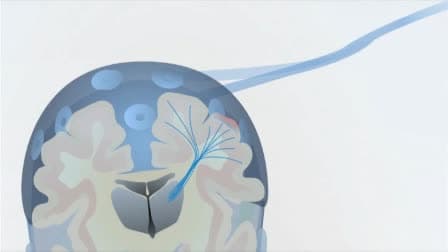 Preterm EEG: A Multimodal Neurophysiological Protocol