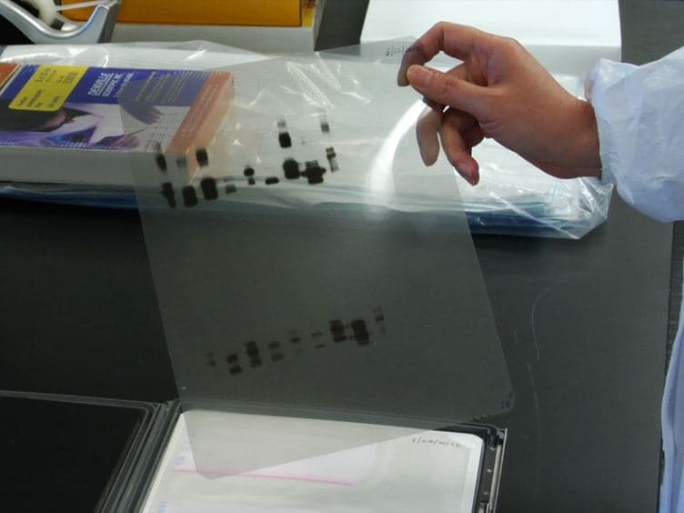 Isolation of Soluble and Insoluble PrP Oligomers in the Normal Human Brain