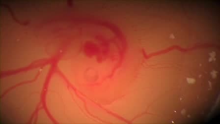 In Ovo Electroporation in Embryonic Chick Retina