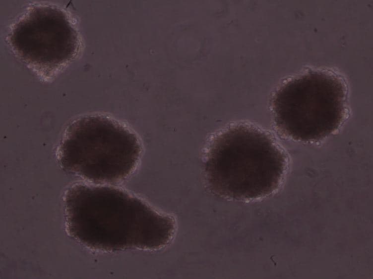Efficient Differentiation of Mouse Embryonic Stem Cells into Motor Neurons