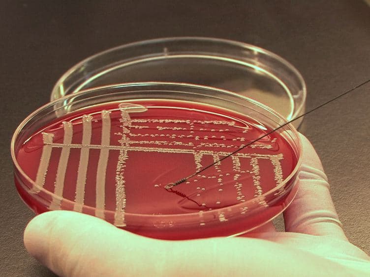 Experimental Endocarditis Model of Methicillin Resistant Staphylococcus aureus (MRSA) in Rat