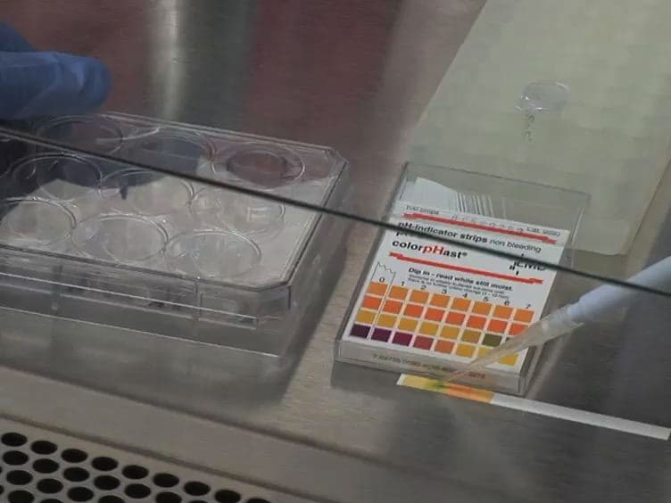 Engineering a Bilayered Hydrogel to Control ASC Differentiation