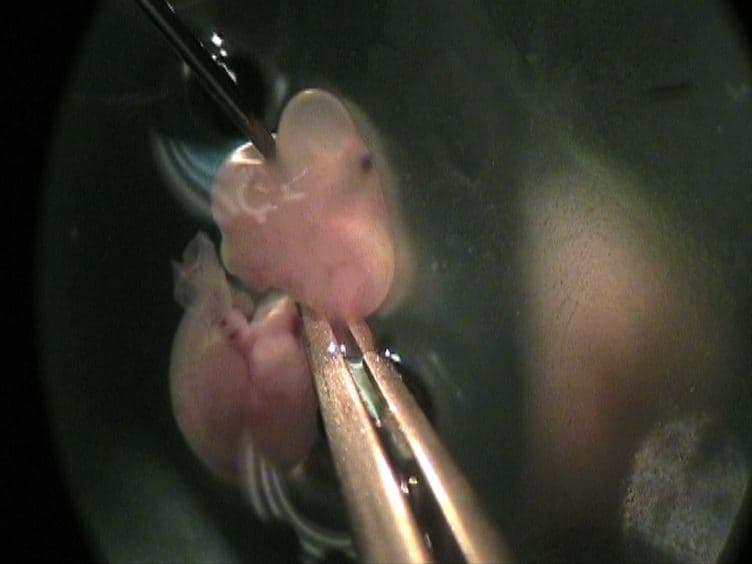 In vitro Electroporation of the Lower Rhombic Lip of Midgestation Mouse Embryos