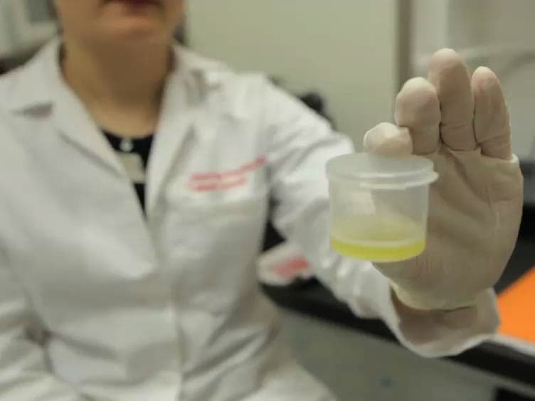 The α-test: Rapid Cell-free CD4 Enumeration Using Whole Saliva
