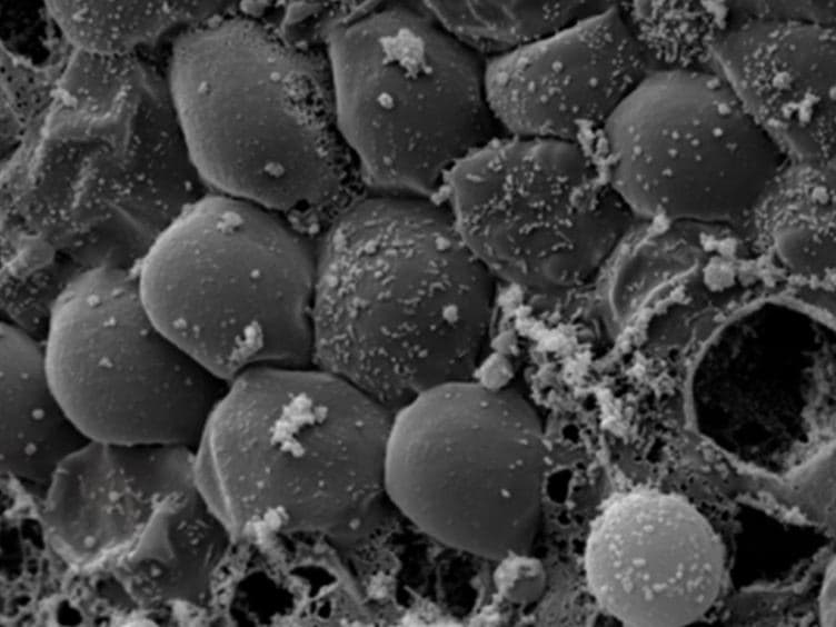 A Human Fallopian Tube Model for Investigation of <em>C. trachomatis</em> Infections