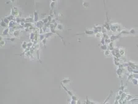 RNA Extraction from Neuroprecursor Cells Using the Bio-Rad Total RNA Kit