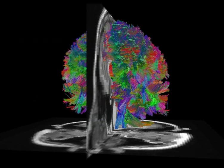 Co-analysis of Brain Structure and Function using fMRI and Diffusion-weighted Imaging