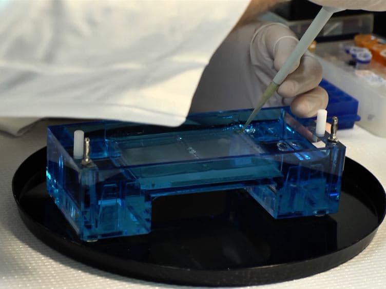 DNA Vector-based RNA Interference to Study Gene Function in Cancer