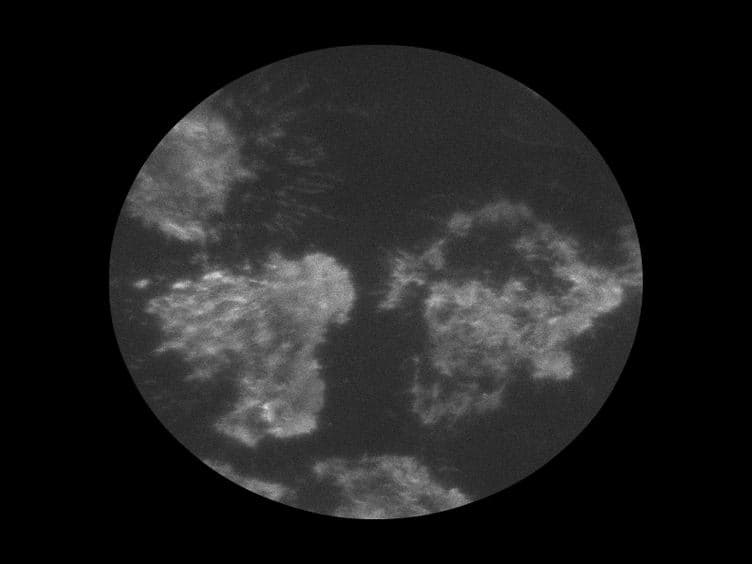 Nanotopology of Cell Adhesion upon Variable-Angle Total Internal Reflection Fluorescence Microscopy VA-TIRFM