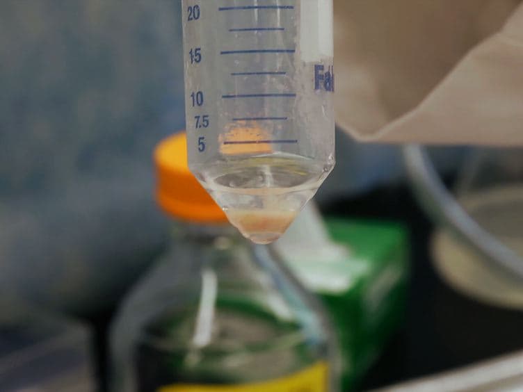 Mouse Islet of Langerhans Isolation using a Combination of Purified Collagenase and Neutral Protease