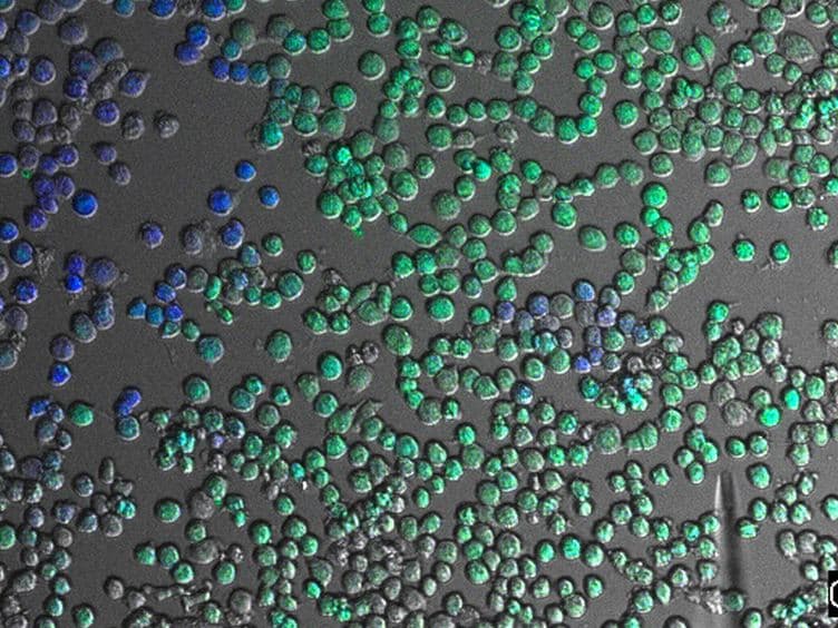 Visualization of Bacterial Toxin Induced Responses Using Live Cell Fluorescence Microscopy