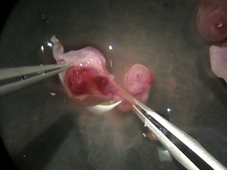 Use of LysoTracker to Detect Programmed Cell Death in Embryos and Differentiating Embryonic Stem Cells