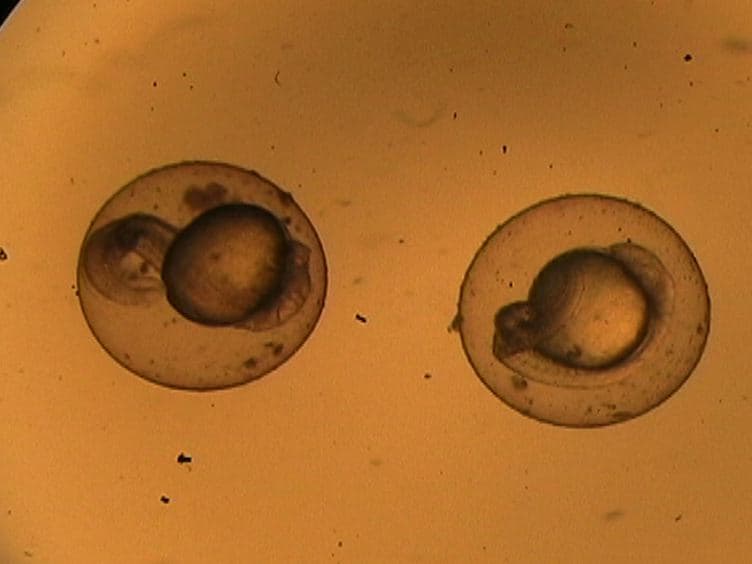 Metabolic Profile Analysis of Zebrafish Embryos