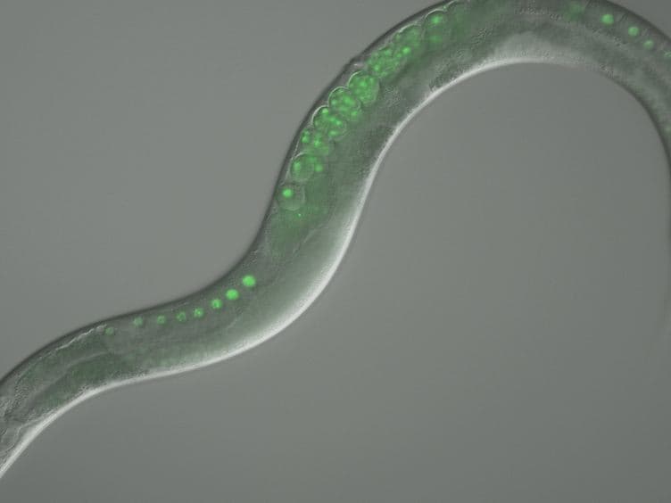 Use of Time Lapse Microscopy to Visualize Anoxia-induced Suspended Animation in C. elegans Embryos
