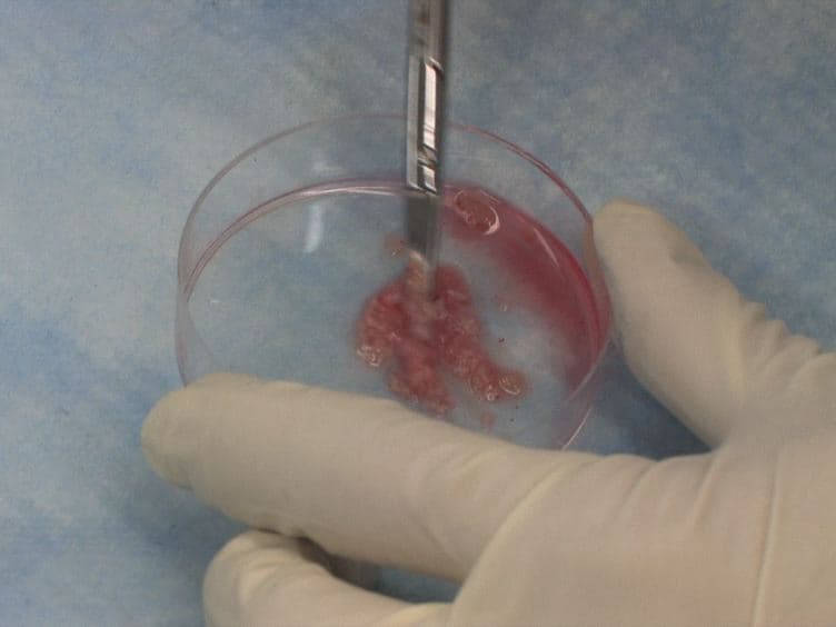 Isolation of Lymphocytes from Mouse Genital Tract Mucosa