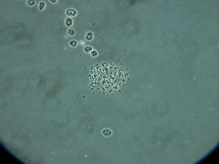 Chromosome Replicating Timing Combined with Fluorescent In situ Hybridization