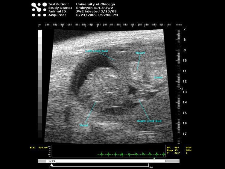 Murine Fetal Echocardiography