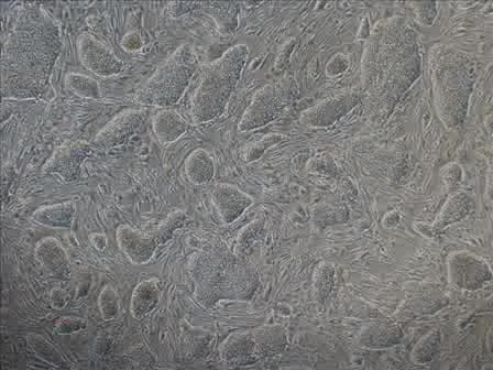 Freezing Human ES Cells
