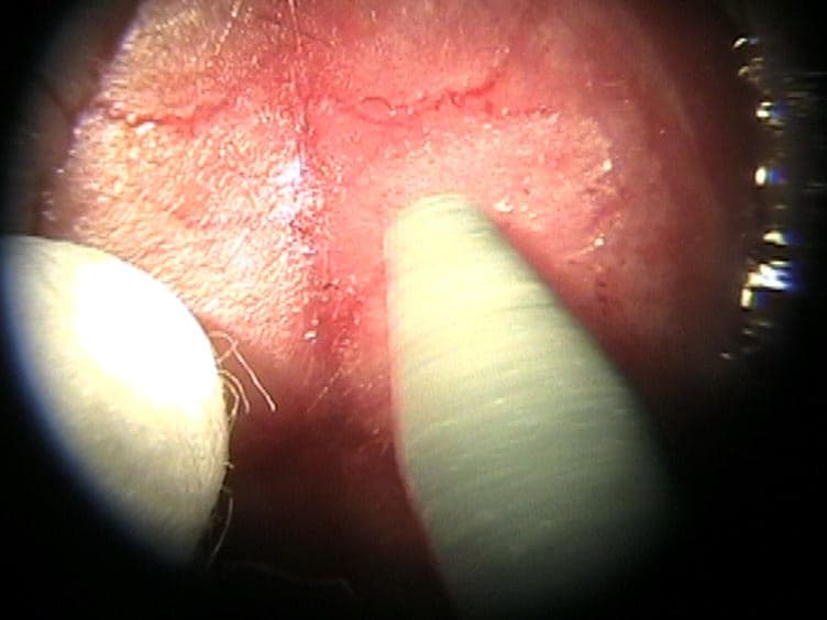 Thinned-skull Cortical Window Technique for In Vivo Optical Coherence Tomography Imaging