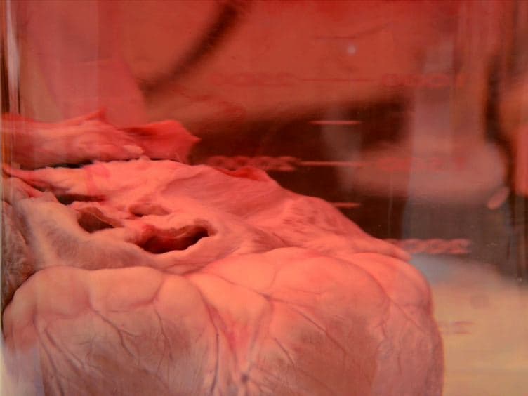 Procedure for Decellularization of Porcine Heart by Retrograde Coronary Perfusion