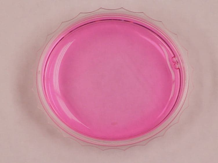 Visualization of Endoplasmic Reticulum Localized mRNAs in Mammalian Cells