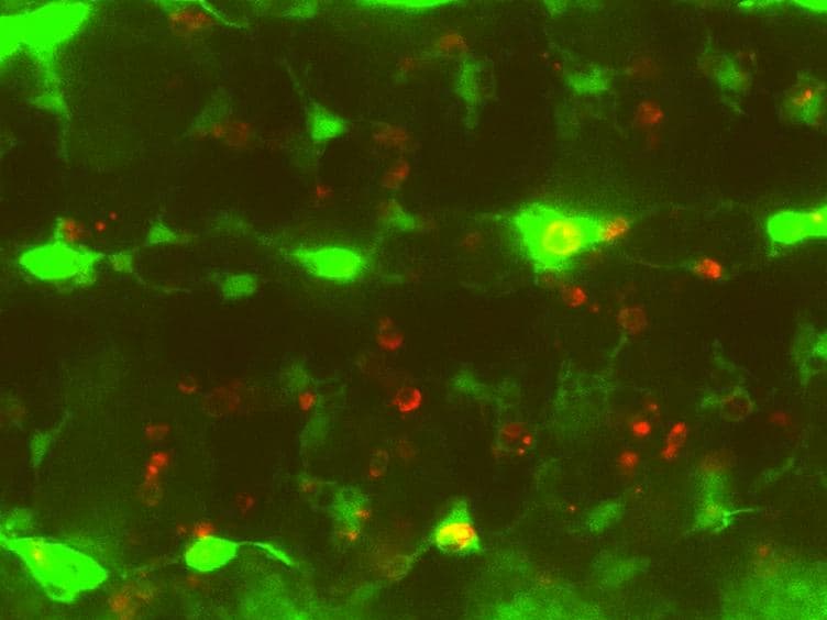 Live Imaging of Apoptotic Cell Clearance during <em>Drosophila </em>Embryogenesis