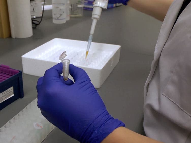 Rapid Colorimetric Assays to Qualitatively Distinguish RNA and DNA in Biomolecular Samples
