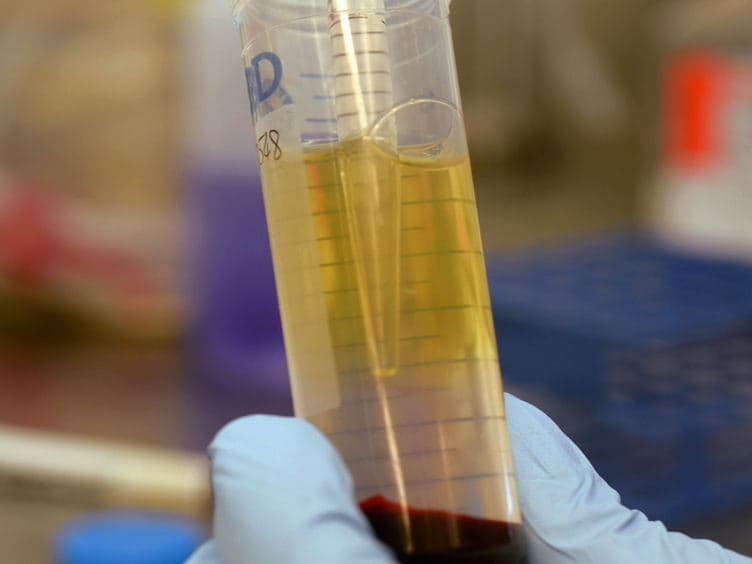 New Tools to Expand Regulatory T Cells from HIV-1-infected Individuals