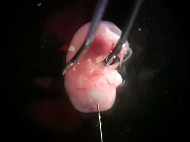 Ex utero Electroporation and Whole Hemisphere Explants: A Simple Experimental Method for Studies of Early Cortical Development