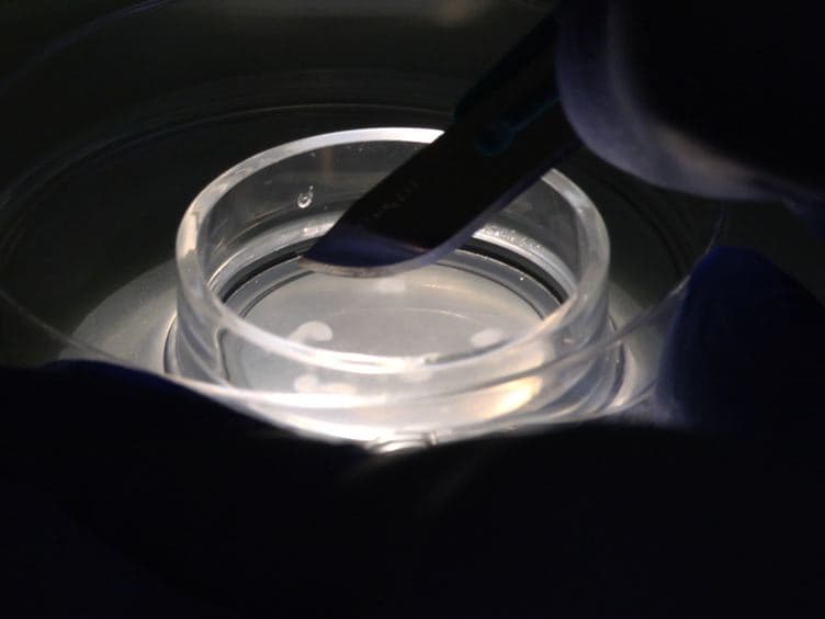 Post-embedding Immunogold Labeling of Synaptic Proteins in Hippocampal Slice Cultures